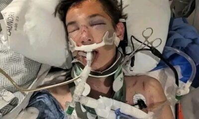 Shocking: Trevor is 17 & a senior @ Hurricane High School, he was in a horrible dirt bike accident on Sunday evening and is ... See more 👇👇